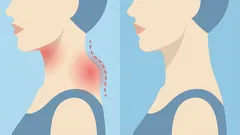 Goodbye, neck hump: 3 actions that can help reduce it — and that I enjoy doing